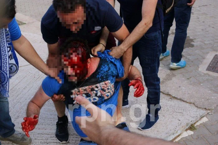 Σοβαρά επεισόδια στα Σπάτα, αιμόφυρτος οπαδός του Εθνικού! (pics, vid)