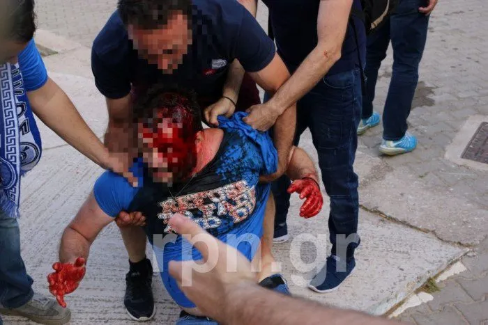 Σοβαρά επεισόδια στα Σπάτα, αιμόφυρτος οπαδός του Εθνικού! (pics, vid)