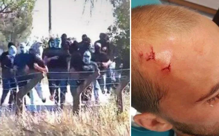 Χαμός στη Σπόρτινγκ - Έκαναν «ντου» και έδειραν παίκτες και προπονητή! (vid)