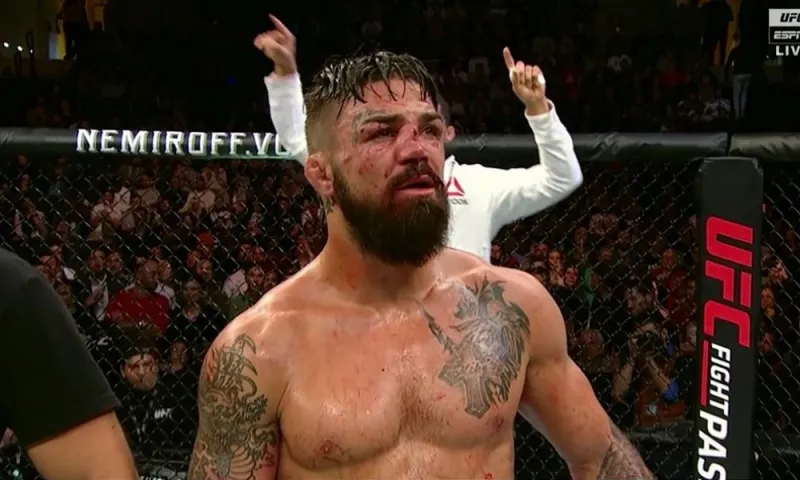 MMA: Φρικιαστικός τραυματισμός για τον Μάικ Πέρι (pics)