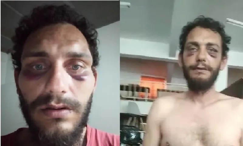 Πολίτης ισχυρίζεται πως αστυνομικοί τον πέρασαν για Πακιστανό και τον σάπισαν στο ξύλο