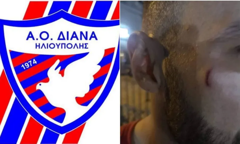 Ηλιούπολη: Επίθεση με μαχαίρι σε φιλικό αγώνα - Του χαράκωσαν το πρόσωπο!