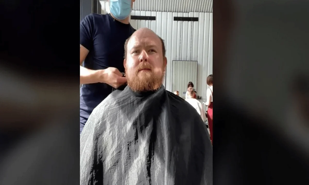 Viral: Απίστευτη αντίδραση άνδρα που απέκτησε ξανά μαλλιά μετά από 10 χρόνια! (vid)