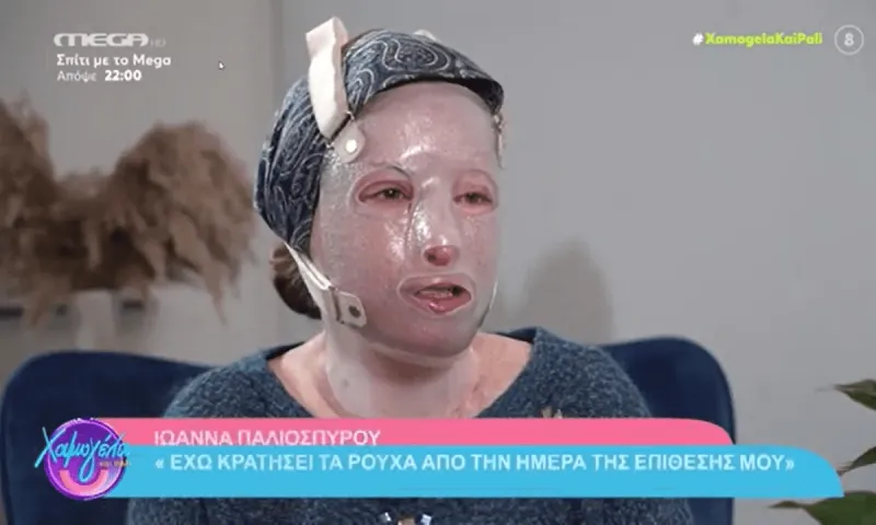 Ιωάννα Παλιοσπύρου: Η συγκλονιστική στιγμή που δείχνει τα ρούχα της από το βιτριόλι (vid)