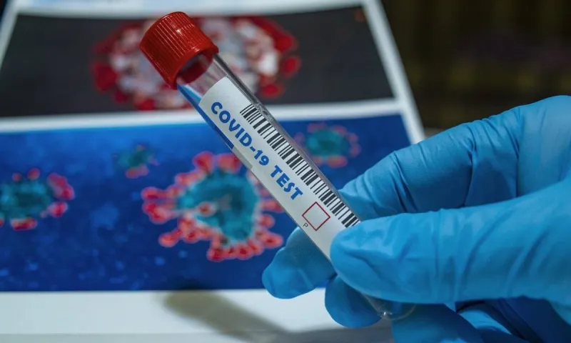 PCR τεστ: Ο Πανελλήνιος Ιατρικός Σύλλογος αδειάζει την κυβέρνηση - «Επικίνδυνη η μείωση της τιμής τους»