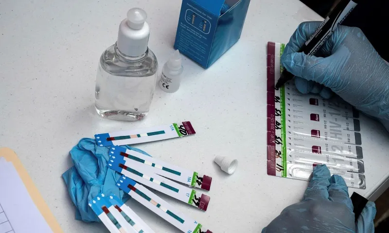 HIV: Ανατροπή με νέα μεταδοτική και πιο παθογόνα μετάλλαξη που εντοπίστηκε στην Ευρώπη
