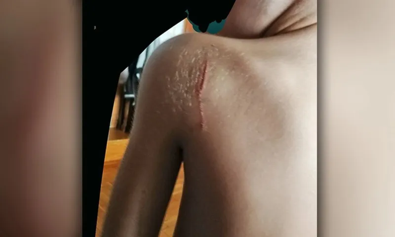 Bullying: Γροθιά στο στομάχι η μαρτυρία του 11χρονου που τον χαράκωσαν – «Με απειλούν - Τα παιδιά είναι ανεξέλεγκτα»