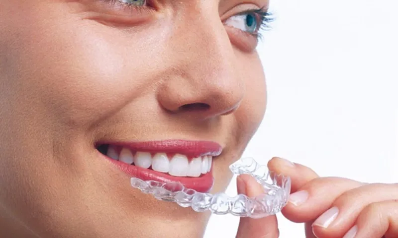 Athens Dental Care: Ίσια δόντια χωρίς σιδεράκια! ΑΟΡΑΤΗ ΟΡΘΟΔΟΝΤΙΚΗ !