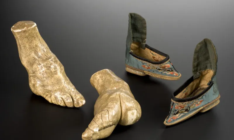 Ήξερες τι είναι το lotus feet; Η παράδοση που κατέστρεφε το σώμα