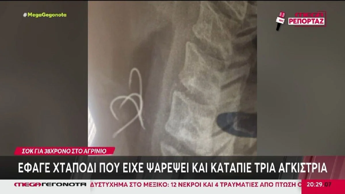 Ψαράς στο Αγρίνιο έφαγε χταπόδι και μαζί 3 αγκίστρια