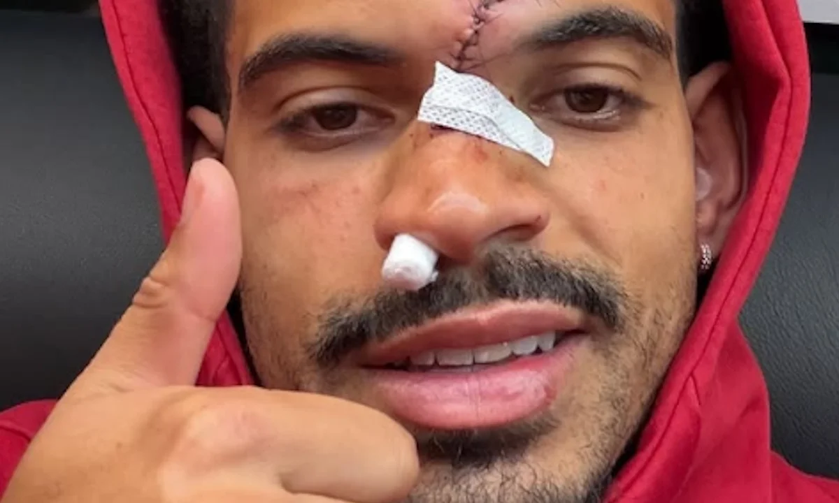 Morgan Gibbs-White τραυματισμός