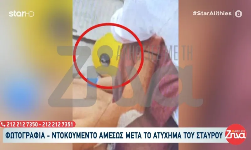 Survivor: Η φωτογραφία – ντοκουμέντο για το ατύχημα του Σταύρου Φλώρου