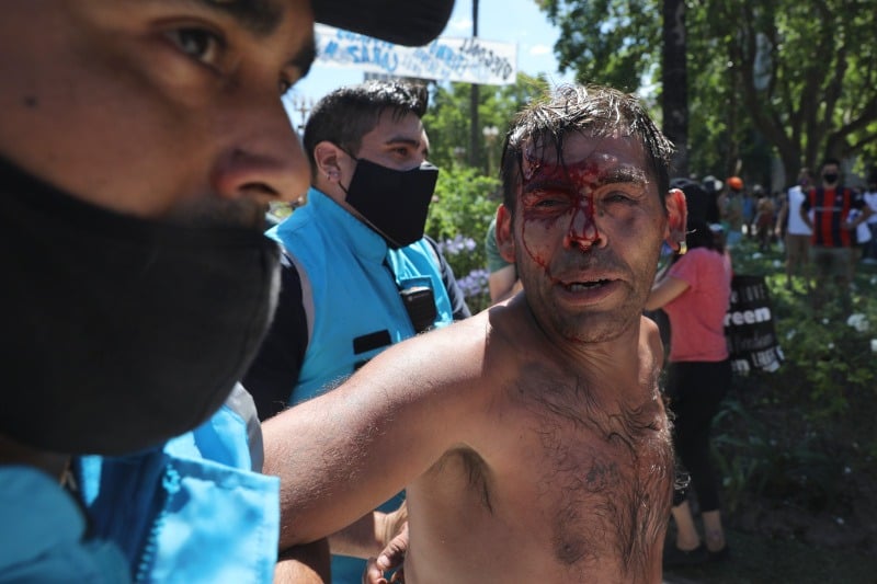 Μαραντόνα