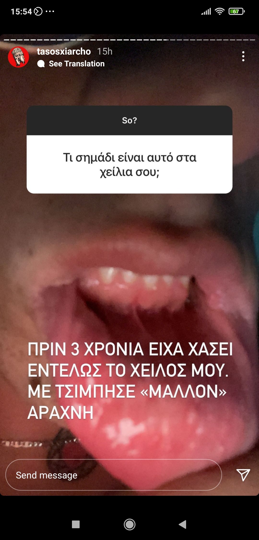Τάσος Ξιάρχος: Σοκαριστικό αυτό που του είχε συμβεί πριν από μερικά χρόνια και αποκάλυψε μέσω του λογαριασμού του στο Instagram.
