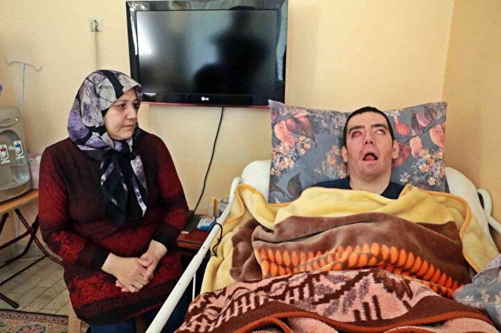 Τουρκία: Απίστευτο δράμα ζει 30χρονος ο οποίος έχει προσβληθεί από σπάνια νόσο που τον αναγκάζει να μην μπορεί να κλείσει τα βλέφαρά του!